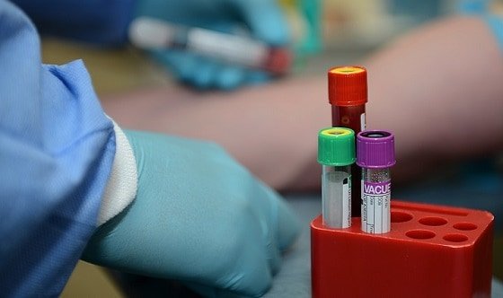 خطوات التعايش مع فيروس نقص المناعة البشري في مصر