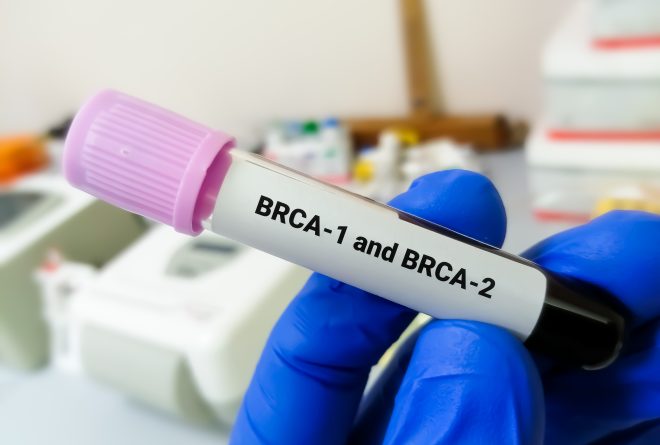 جينات ال  BRCA: هل من الممكن معرفة احتمالية الإصابة مستقبلاً بسرطان الثدي؟